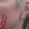 Anti-fox hunt protester attacked at Atherstone Hunt meet