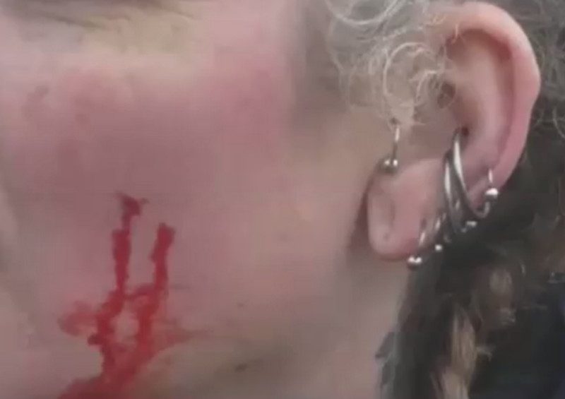 Anti-fox hunt protester attacked at Atherstone Hunt meet