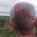 Police probe assault claims after Middleton Hunt demo