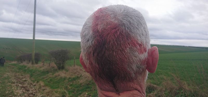 Middleton Hunt leave one saboteur with a head injury